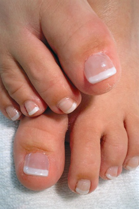 toe-nail-acrylics-34-12 Acrilici pentru unghii de la picioare