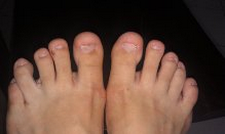 toe-nail-acrylics-34 Acrilici pentru unghii de la picioare