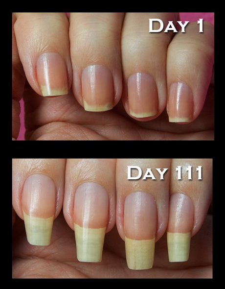 gel-nails-problems-48_2 Probleme cu unghiile cu Gel