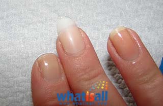 what-is-gel-nails-15_19 Ce este unghiile cu gel