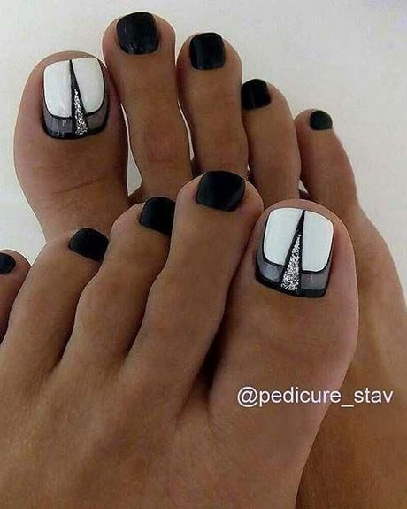 black-and-white-toe-nail-design-75 Design de unghii alb-negru