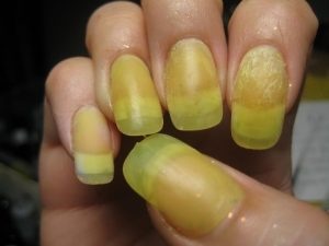 yellow-acrylic-nails-06_6 Unghii acrilice galbene