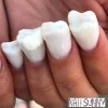 Modele de unghii pentru dinți